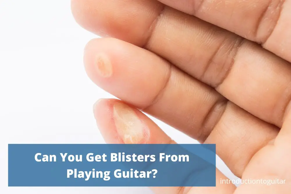 can-you-get-blisters-from-playing-guitar